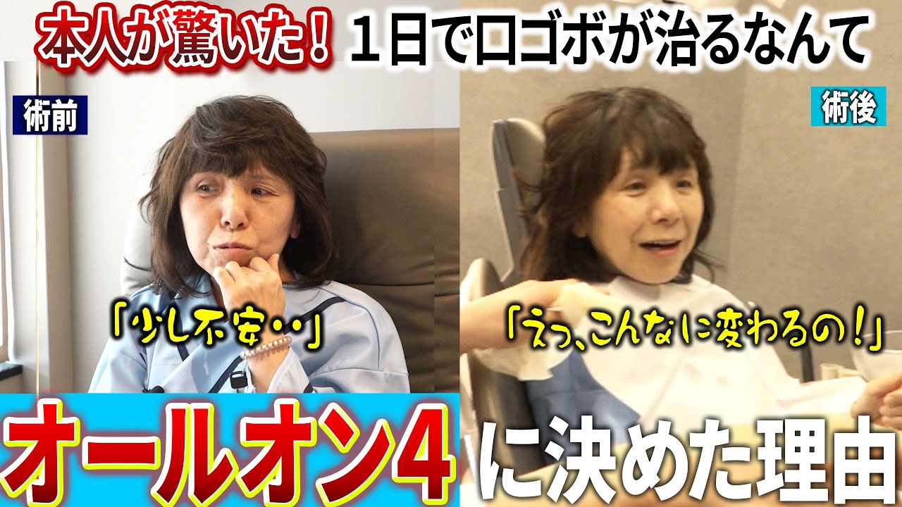 本当に驚きました！歯だけではなく長年悩んでいた口ゴボまで治るなんて…ナルト先生も笑顔になったオールオン4に決めた理由シリーズ