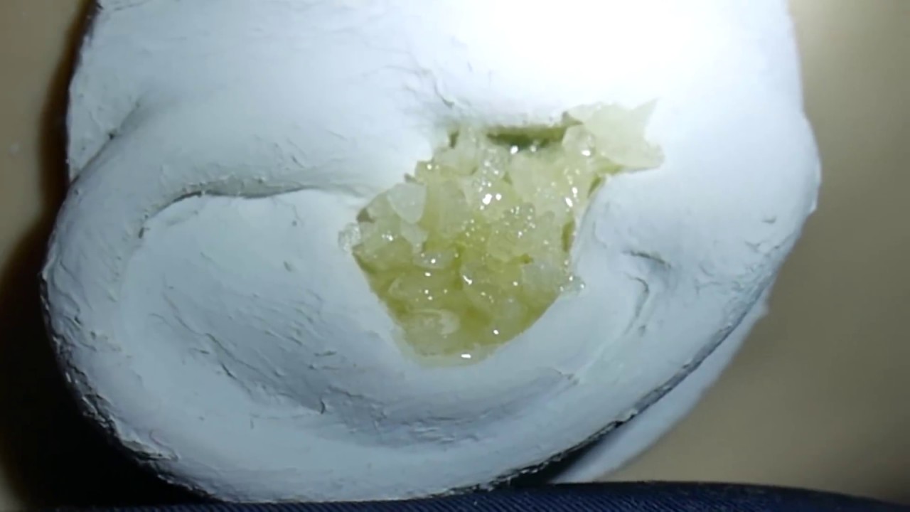 ASMR Your ears are full of earwax 11 - Pop Rocks 2 / Popping Sound / Ear Cleaning (No Talking