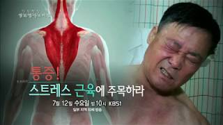 170712 생로병사의비밀 예고 ㅣ KBS방송