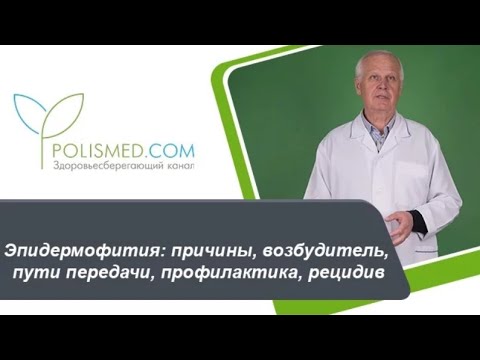 Эпидермофития: причины, возбудитель, пути передачи, профилактика, рецидив