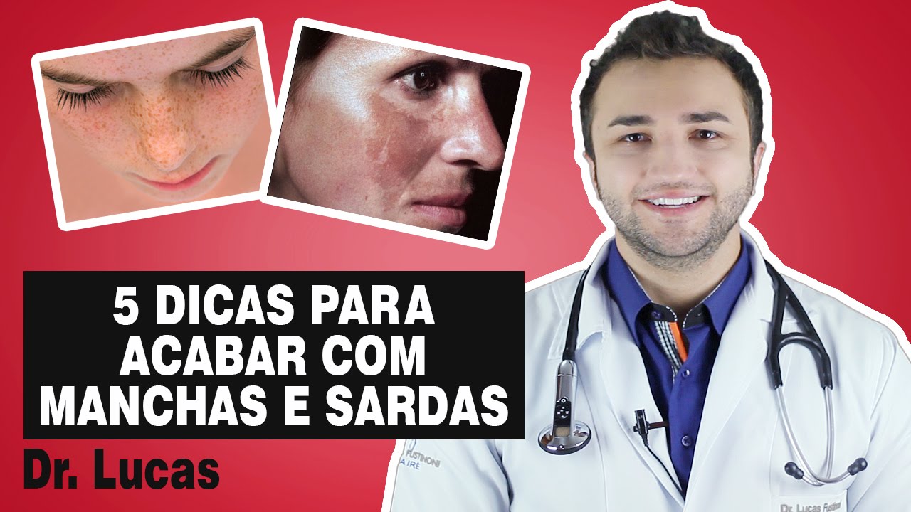 5 Dicas Para Combater Manchas e Sardas - Dr Lucas Fustinoni