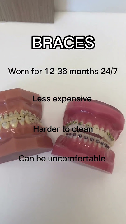 Braces VS Invisalign 🦷👀