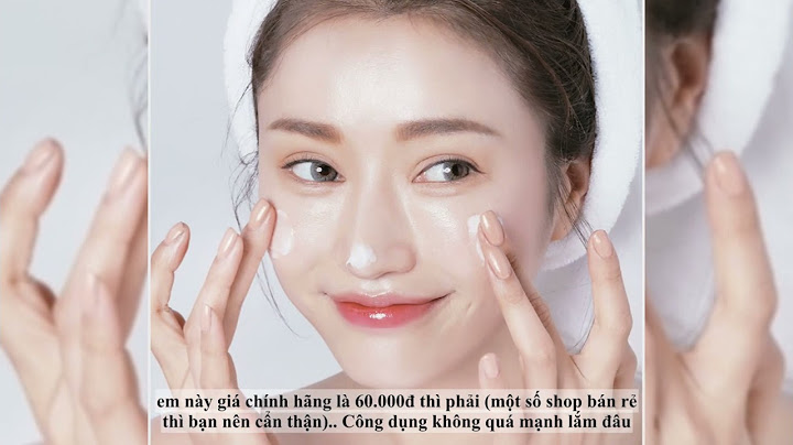 Kem trị mụn acnes giá bao nhiêu