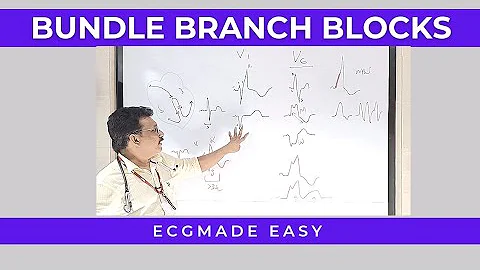 ECG MADE EASY || BUNDLE BRANCH BLOCK