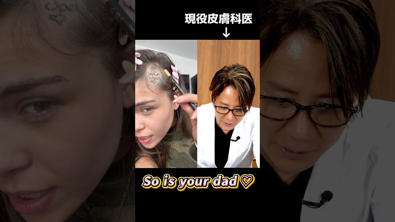 円形脱毛症の治療法はありますか？#shorts