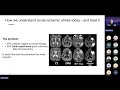 Webinar: The Technology Behind Perfusion Maps - Presented by Prof. Leif Østergaard
