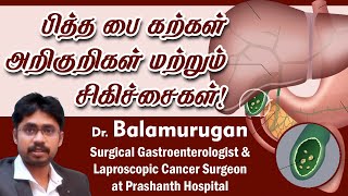Gall bladder Stones | Symptoms & its treatment | பித்த பை கற்கள் | Dr.Balamurugan