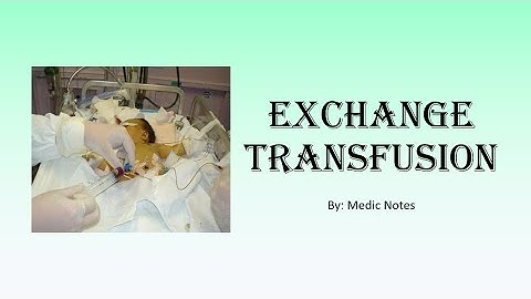 [Houseman preparation procedures] Exchange transfusion - indication, procedure, complication