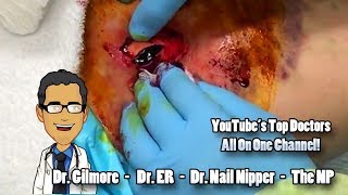 Dr ER's Big Bite