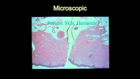 AIMIS Video CME Sample