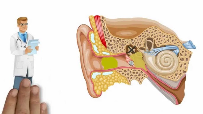 Comment BIEN se laver les oreilles ? - WhyDoc #22 