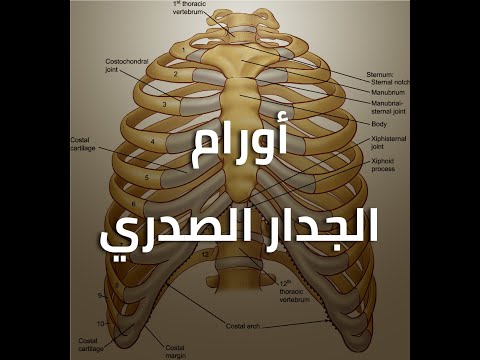 أورام الجدار الصدري