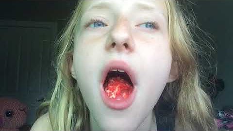 Pop-rocks And Coke Challenge