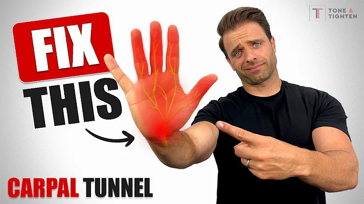 FIX Carpal Tunnel! Stretches And Exercises For Carpal Tunnel Symptoms