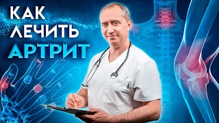 Как Лечить Артрит Сустава?