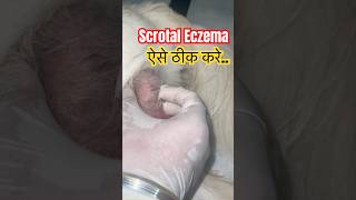 Scrotal Eczema in dogs treatment