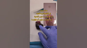 الم الخصية لا تهمله 