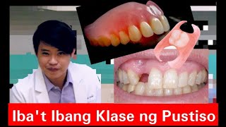 Iba't Ibang Klase ng PUSTISO! Metal, Flexible, Stayplate, Complete Denture! #20