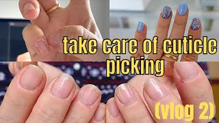 nail vlog 2: How to take care of cuticle picking