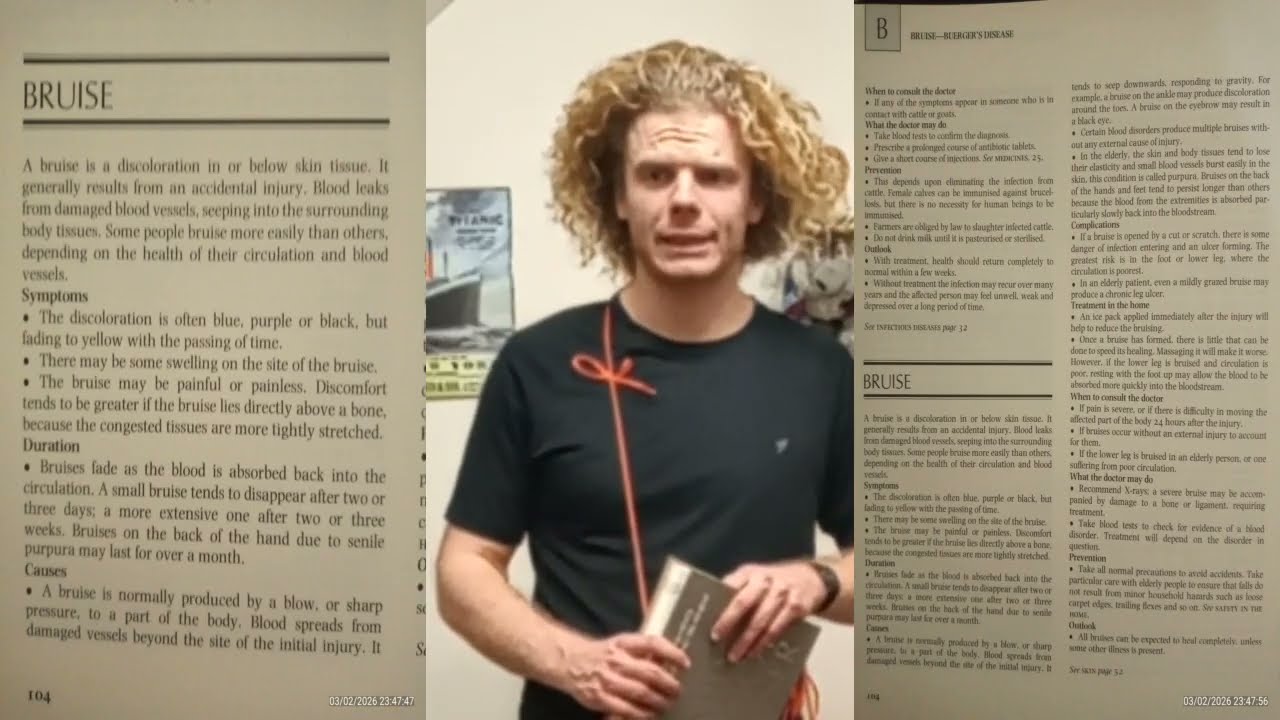 Medicine Part 170, Bruises, and ECU Strength Training, Reg. WCZAVFBZ