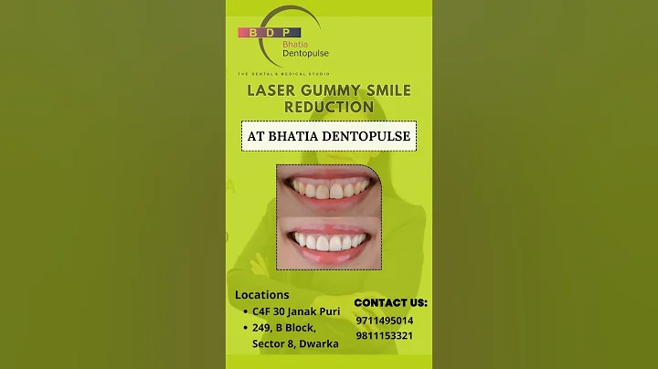 LASER Gummy Smile Reduction at Bhatia Dentopulse: Dr. Srishti Bhatia #smile #gummysmile