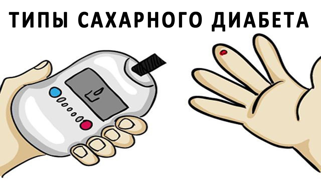 Типы сахарного диабета. Классификация диабета