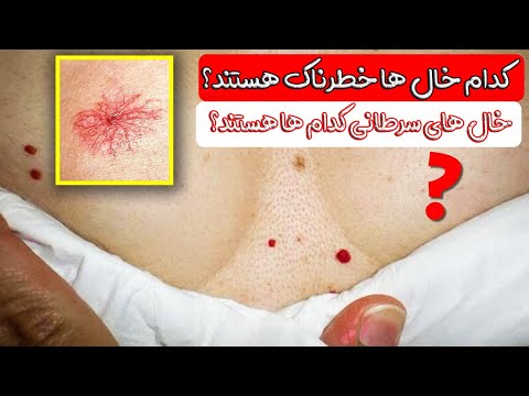 تصویری: چرا رنگ لبم کمرنگ شده است؟