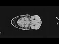 ニジイロクワガタの断層画像 | CT生物図鑑