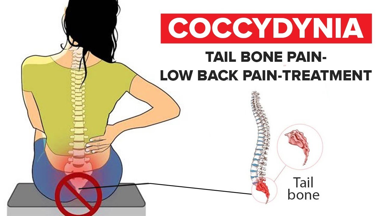 🥇 NYC Coccydynia (Tailbone Pain) Treatment, Causes