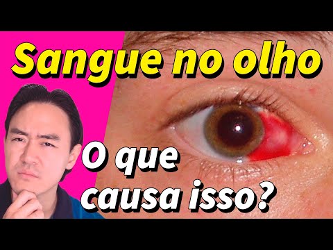 Vídeo: Como começa a hemorragia subconjuntival?