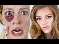 BLACK EYE to BEAUTIFUL - Cover Up Makeup Tutorial
