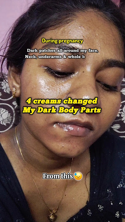 My body brightening skincare routine for hyperpigmentation! 🤯🚨✨️ #beforeandafter #skincare #shorts