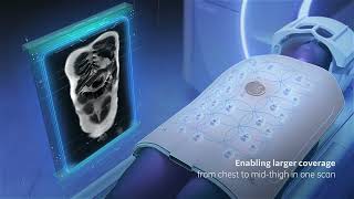 MRI with AIR Touch™ Solution (3D animation by Arcreative 2023) by Arcreative 2,128 views 1 year ago 50 seconds