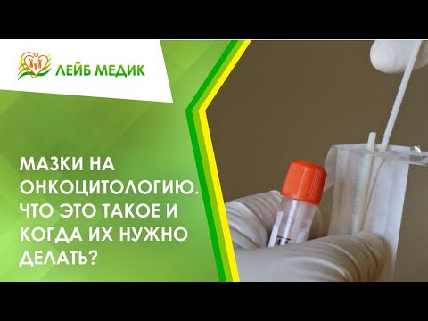 🧫 Мазки на онкоцитологию. Что это такое и когда их нужно делать?