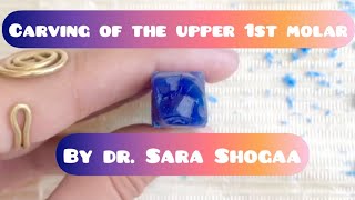 Carving of the upper 1st molar (part 1) by Dr. Sara shogaa