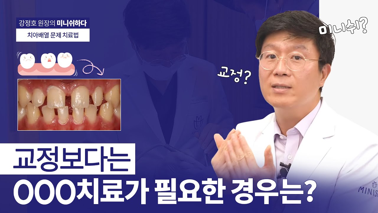 치아 사이 공간이 생겼다? | 교정 없이 가능한 치아 복구치료, 미니쉬