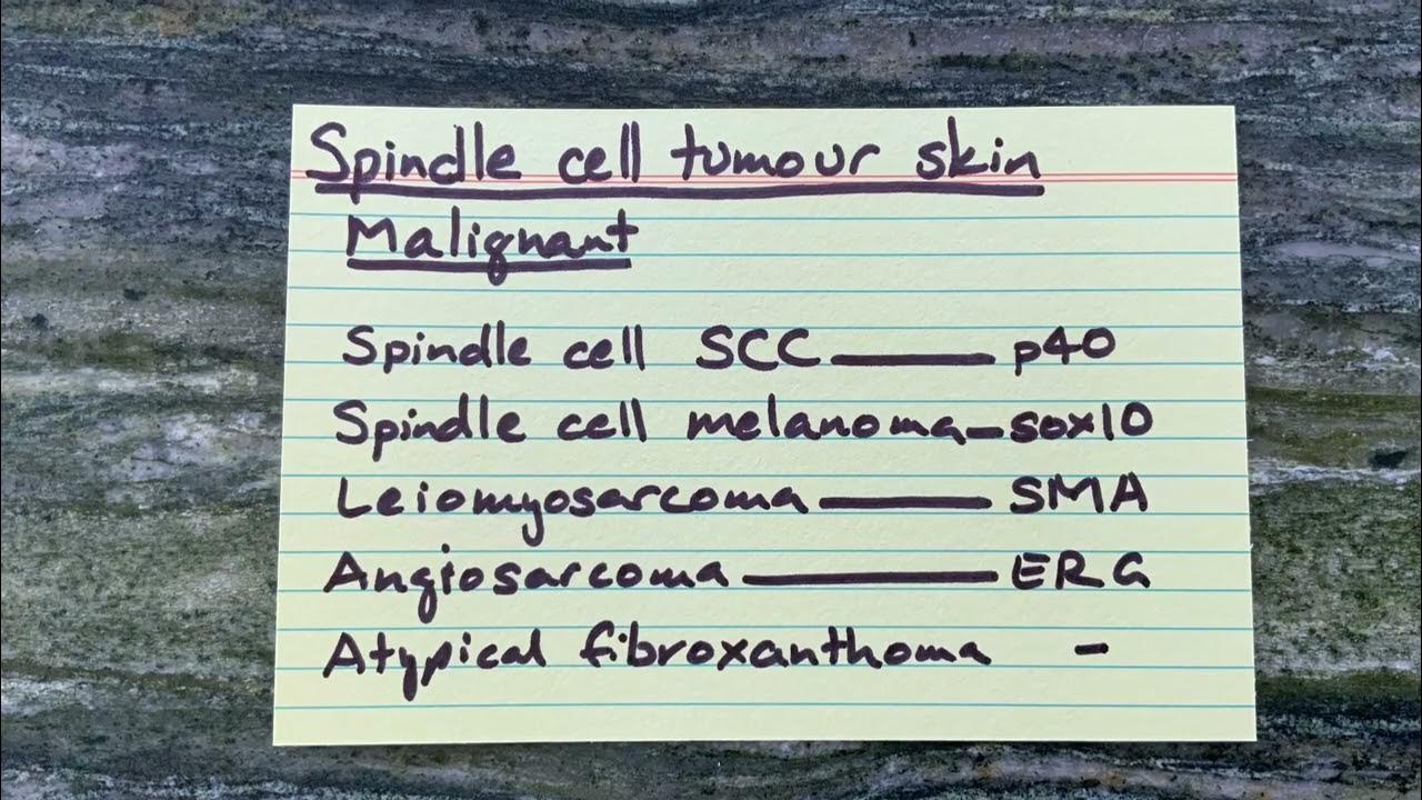 Differential diagnosis of a malignant spindle cell tumor in skin YouTube