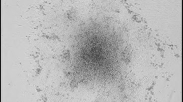 [JuLI Stage Application Video] Mesenchymal stem cell images for 144 hours