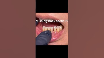 Missing back teeth ? Implants expensive? Dislike  partial dentures?