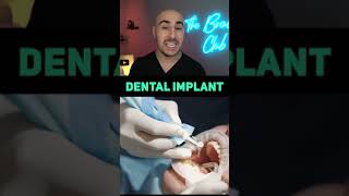 Dental Implants vs Bridges vs Braces - Missing Teeth 101 #shorts