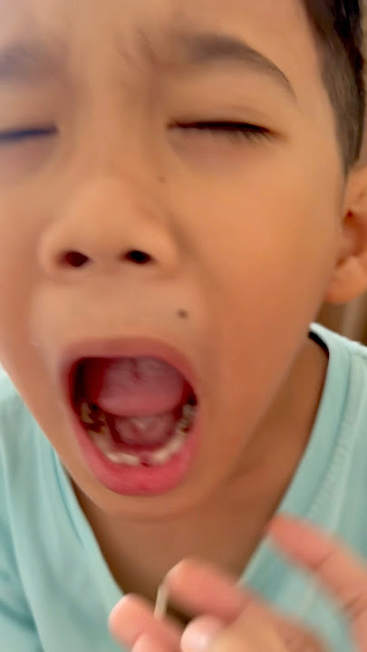 Mommy didn't pull out his tooth, but Keizo screamed‼️