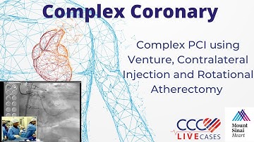 Complex PCI using Venture Contralateral Injection & Rotational Atherectomy –April 2010 Webcast Video