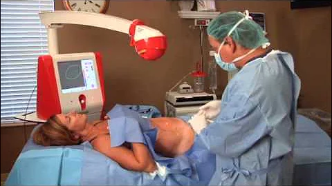 GPS Laser Lipo Procedure Part 1