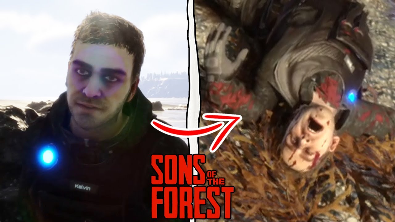 Sons of the Forest Kelvin: How to heal Kelvin, can he die, and do you need  to feed him?