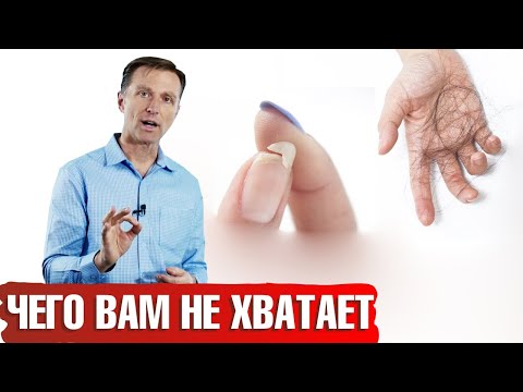 Видео: Что вызывает обесцвечивание ногтей?