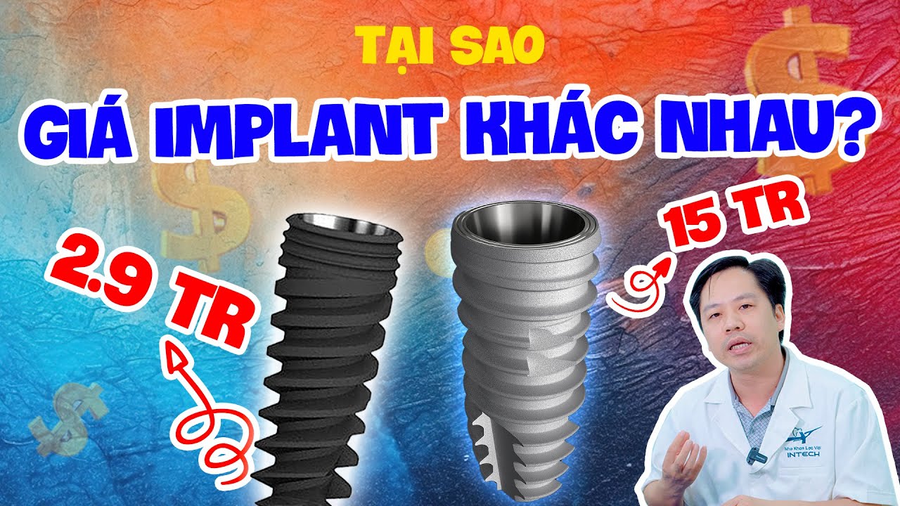 Outline Video Trồng Răng Implant Giá Bao Nhiêu 2024 - Tại Sao Giá Trồng Răng Implant Lại Khác Nhau?