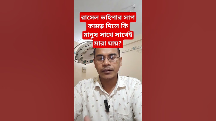 রাসেল ভাইপার সাপ কামড় দিলে কি মানুষ সাথে সাথে মারা যায়?রাসেল ভাইপার সাপ কতটা ভয়ংকর। #russellviper