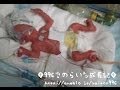 996gで生まれたらいトンの成長動画 ［超低出生体重児、未熟児］