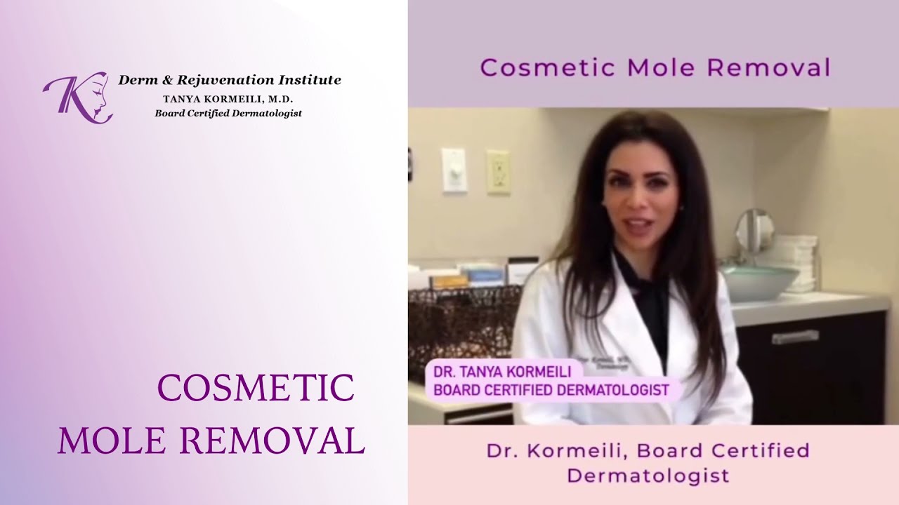Cosmetic Mole Removal in Santa Monica, Best dermatologist in Santa Monica. YouTube
