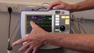 How to use the Zoll R series plus defibrillator screenshot 5